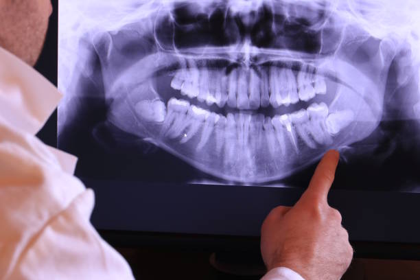 Best Emergency Root Canal Therapy in Ocean City, FL