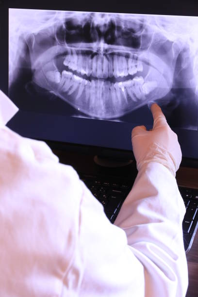Best Broken or Chipped Tooth Repair in Ocean City, FL